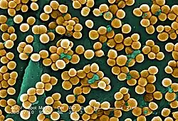Colorized micrograph: sphere-shaped bacteria clustered in grape-like bunches.