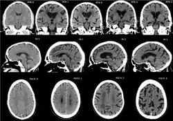 Brain images