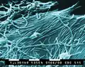 Ebola virus (Filoviridae)
