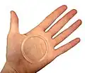 a vaginal ring