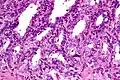 High magnification micrograph of seminal vesicle. H&E stain.