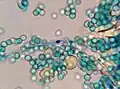 Fruit mold with spores and distinguishable cellular growth (2000x)